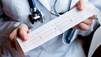 Dos de los 4 pacientes