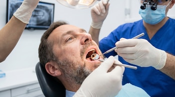 Hombre en silla dental con la boca abierta. Dos profesionales con guantes examinan sus dientes con instrumentos, uno de ellos un espejo que revela una carie.