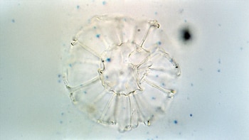 Microorganismo translúcido con estructura radial y finos filamentos, sobre un fondo claro salpicado de pequeños puntos azules y negros