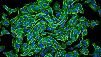 Microfotografía de células en un fondo negro, con núcleos azules y citoplasma de color verde fluorescente que forma patrones ondulantes