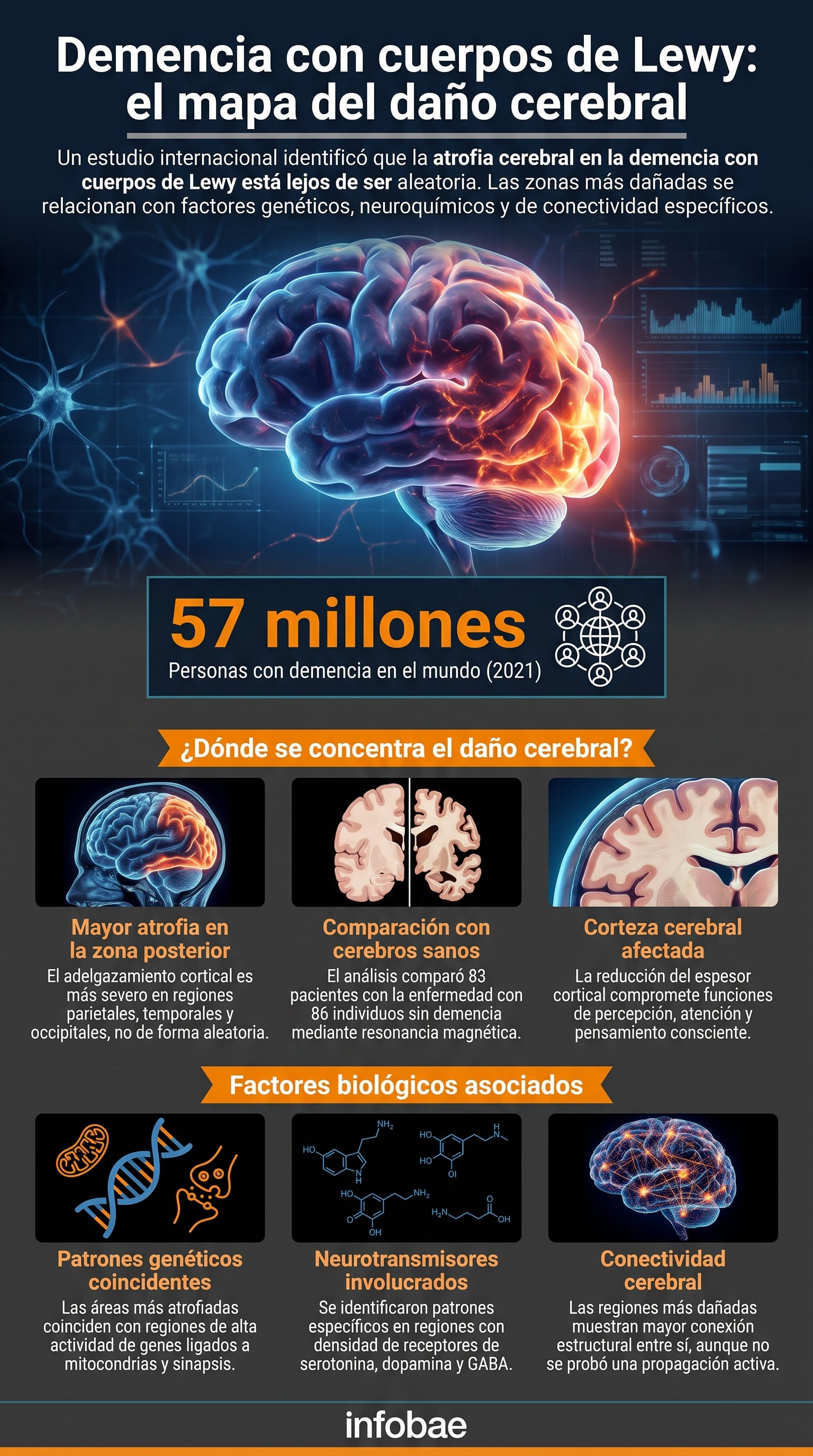 Un estudio publicado en Journal of Biomedical Science indicó que el adelgazamiento de la corteza cerebral en la demencia con cuerpos de Lewy sigue un patrón definido y no aleatorio. (Imagen Ilustrativa Infobae)