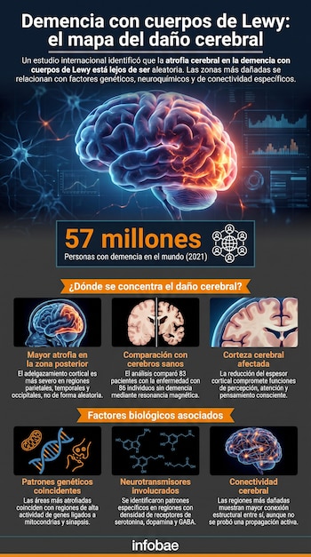 Infografía con una ilustración 3D del cerebro, cifras globales sobre la demencia y seis tarjetas explicativas con esquemas anatómicos y genéticos.