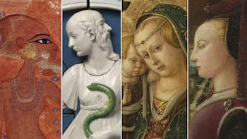 La alopecia en la historia