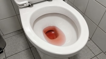 Un inodoro blanco con líquido rojizo en la taza. Se ven azulejos blancos en la pared y azulejos grises en el suelo, y un cubo metálico.