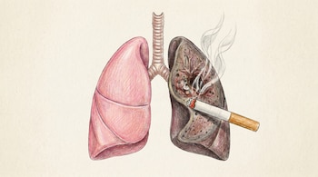 Ilustración a color estilo lápiz de dos pulmones, uno rosa y sano, y otro oscuro y afectado por un cigarrillo encendido, sobre fondo neutro.