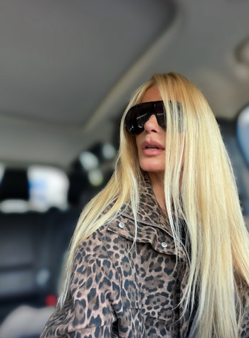 La lesión de Mary Méndez no evolucionó como esperaba, por lo que requerirá tratamiento médico y reposo - crédito @marymendez55/ Instagram