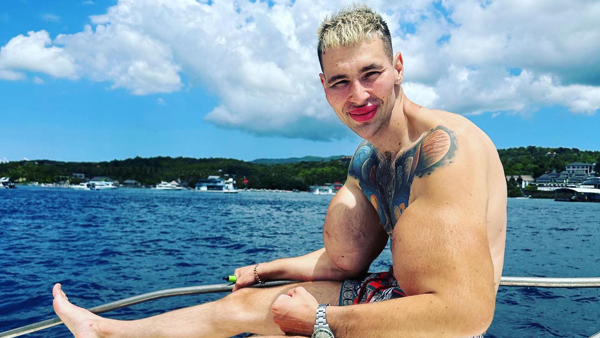 Kirill Tereshin, el Popeye Ruso. Es el hombre con los bíceps más grandes del mundo y podrían amputarle los dos brazos por una infección (@kirilltereshin96)