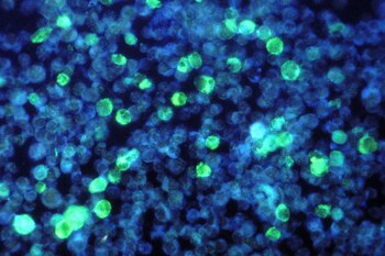 La mononucleosis es una infección contagiosa causada por un virus del herpes llamado Epstein-Barr. Otros virus también pueden causar mononucleosis (Photo by Smith Collection/Gado/Getty Images).