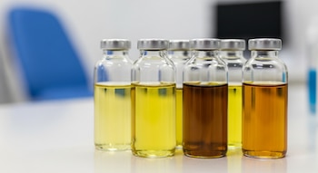 Primer plano de vasos transparentes con muestras de orina en tonos amarillo claro, amarillo oscuro y ámbar, alineados en una mesada de clínica.