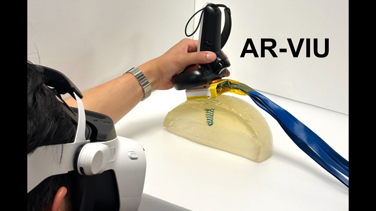 El MIT desarrolló AR-VIU para reducir la carga cognitiva de reconstruir cortes de ecografía 2D en una imagen mental 3D durante la exploración (MIT)