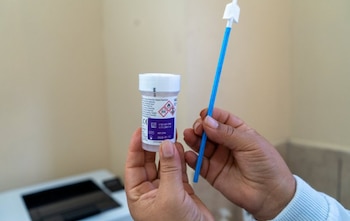 San José Pinula sumó las pruebas PCR a los servicios de Papanicolaou, inspección visual con ácido acético y vacunación para detectar cáncer de cérvix.