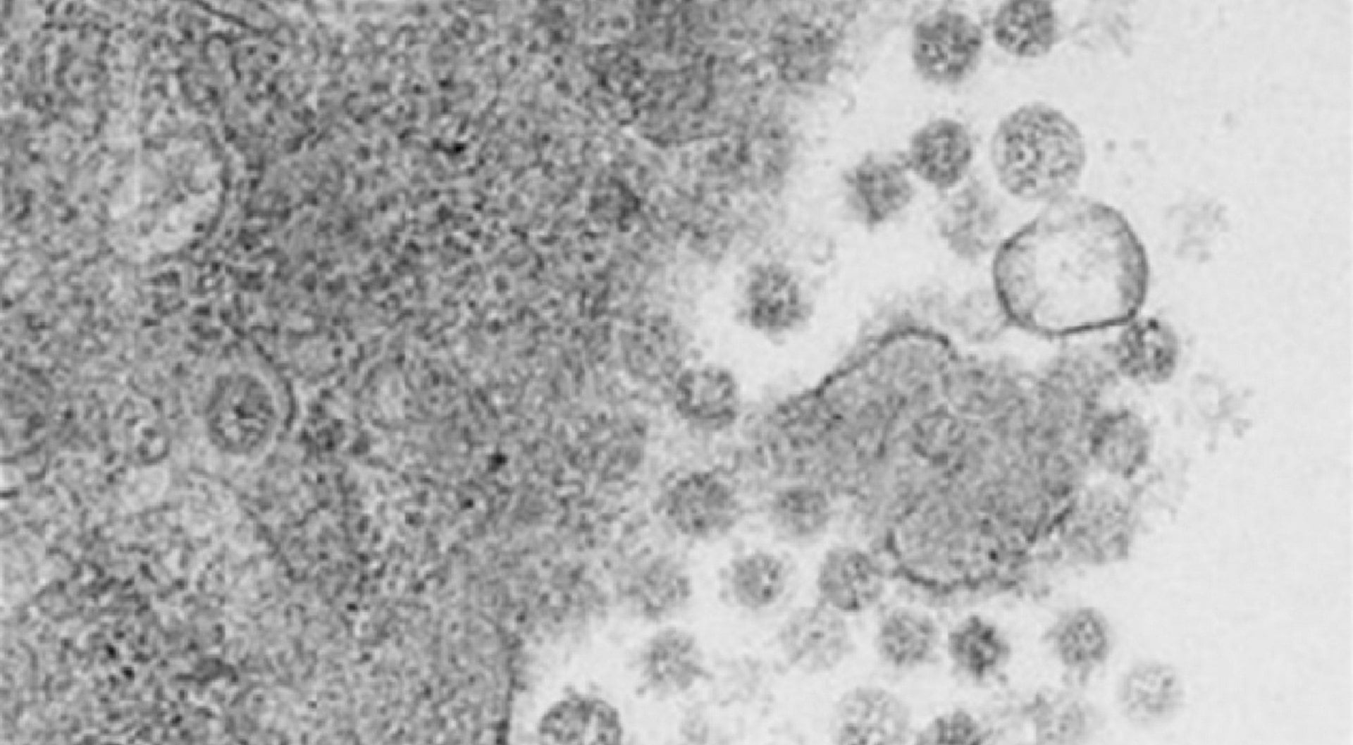 Virus del SARS-CoV-2 saliendo de las células infectadas (CSIC/EQUIPO DE LUIS ENJUANES_PNAS)