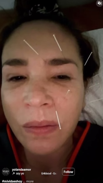 El video muestra el proceso