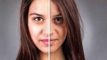 El envejecimiento prematuro se manifiesta