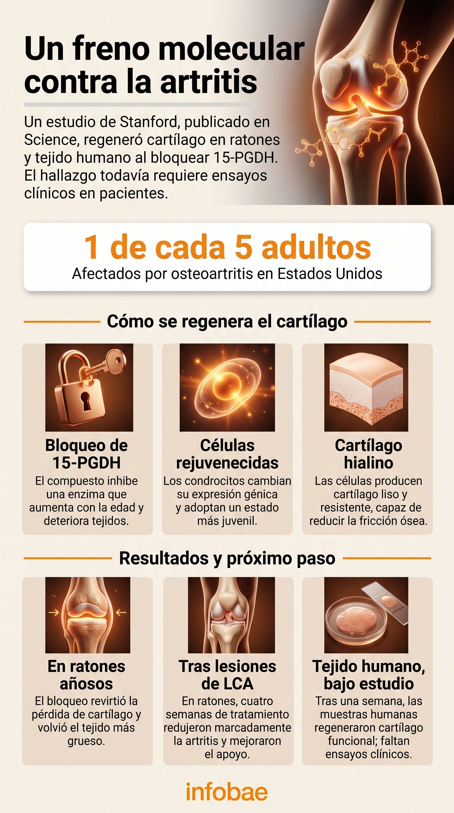 Un estudio de la Universidad de Stanford detalla el proceso de regeneración del cartílago articular mediante el bloqueo enzimático (Imagen Ilustrativa Infobae)