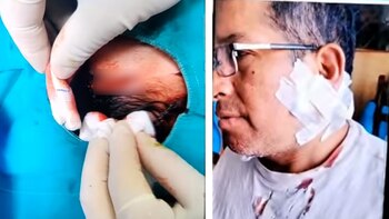 Mesera es desfigurada por otra