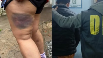 Tenía denuncias por violencia de género, atacó a su ex pareja con un garrote y fue detenido en Chaco