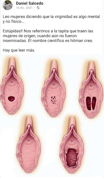 Hombre intentaba describir el himen
