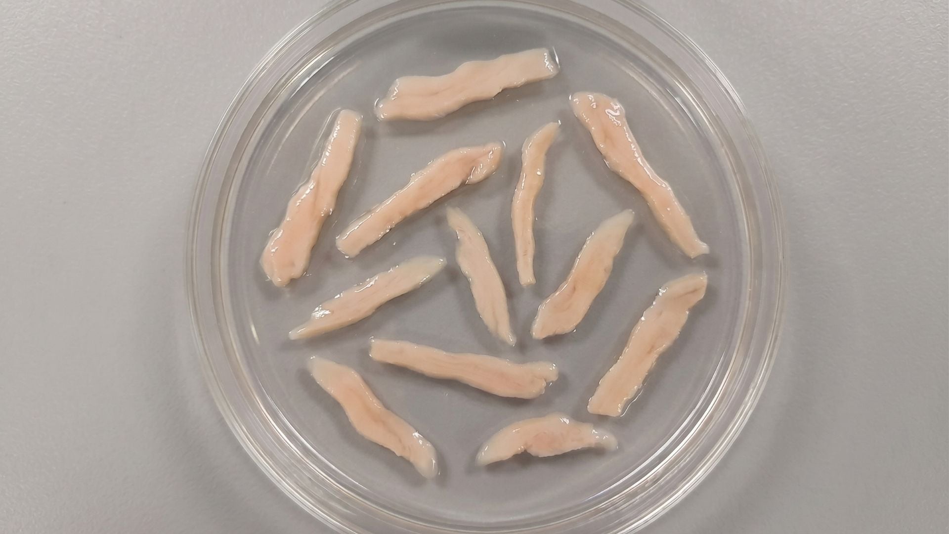El equipo de la Universidad de Aberdeen creó cerebroides para preservar mejor la estructura, la diversidad celular y la organización de la corteza cerebral fetal (Imagen Ilustrativa Infobae)