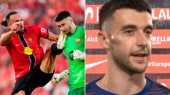 Así le quedó la cara