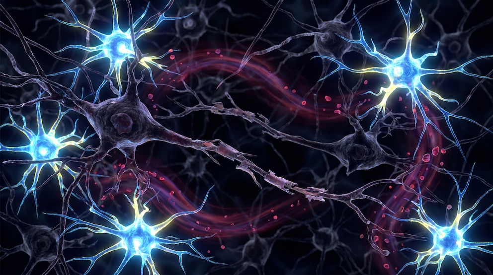 Ilustración microscópica de neuronas motoras y células gliales vinculada con la progresión de la ELA.