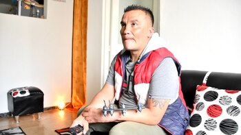 Hombre recuperó sus brazos después