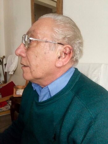 Oreja cosida por veterinario