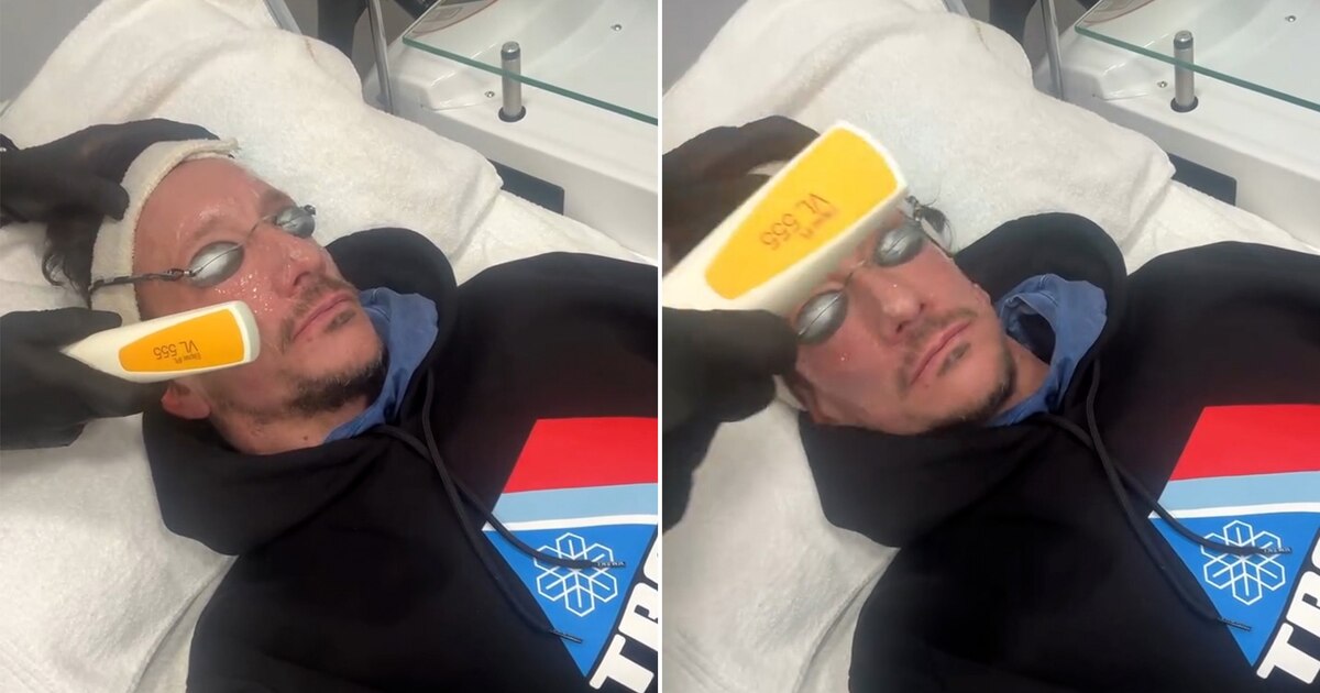 Nico Vázquez Revela su Secreto para una Piel Radiante: Un Tratamiento Dermatológico de Vanguardia