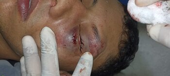 Asonada en El Tarra, Norte