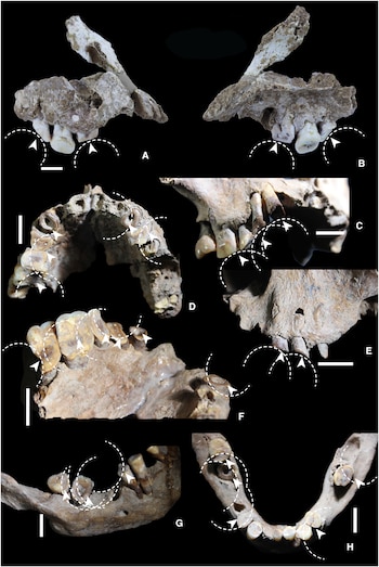 Desgaste dental relacionado con el consumo de drogas en los primeros cazadores-recolectores de Sulawesi (Science Advances)