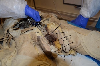 Imagen de la disección del