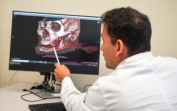 El Hospital Almenara realiza cirugías