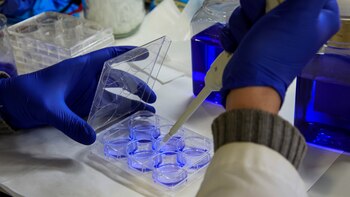 Un estudio cifra en 451