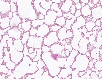 bacteria