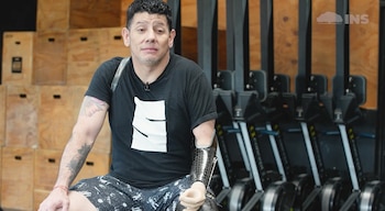 Cristian Oporta perdió una pierna