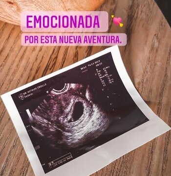 (Foto: Instagram@paulinagoto)