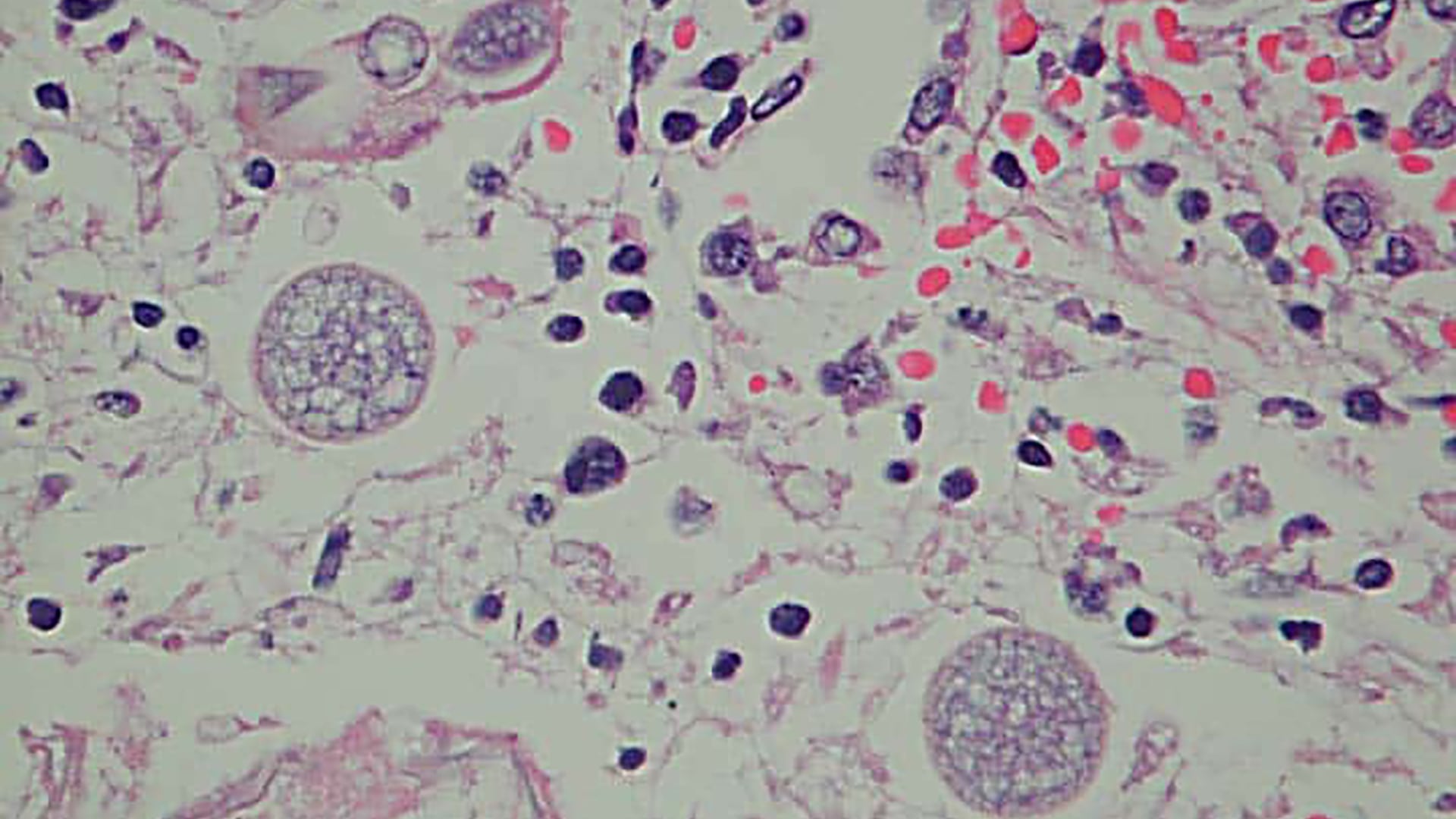 El hongo puede causar infecciones graves al ser inhalado por personas y animales/Archivo