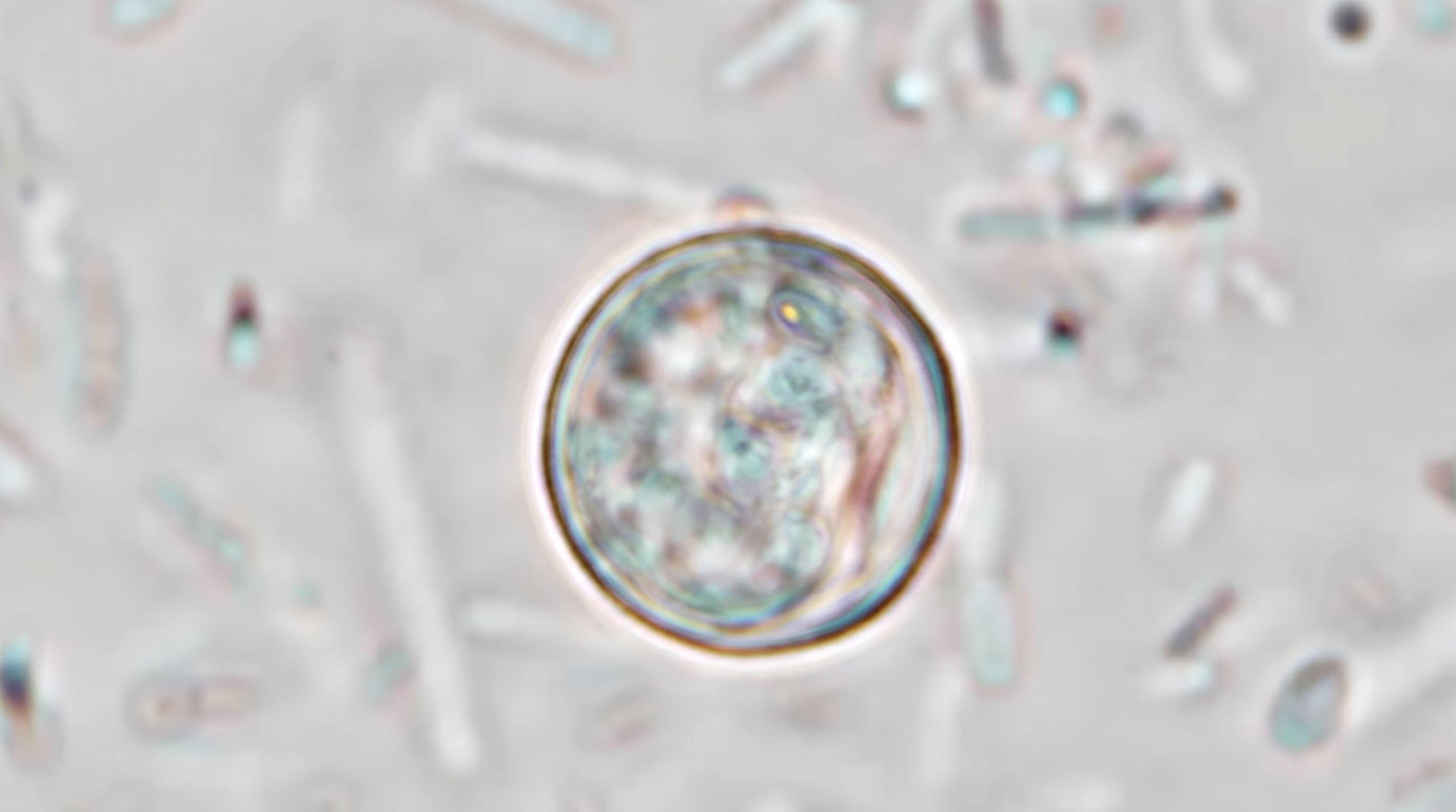Cyclospora cayetanensis causa ciclosporiasis, una enfermedad intestinal que se transmite por productos frescos y agua contaminados con heces humanas (CDC)