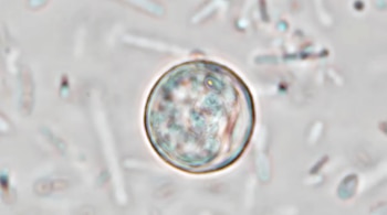 Microfotografía de un Cyclospora cayetanensis esférico y translúcido con estructura interna visible, sobre fondo blanco grisáceo desenfocado con restos biológicos.
