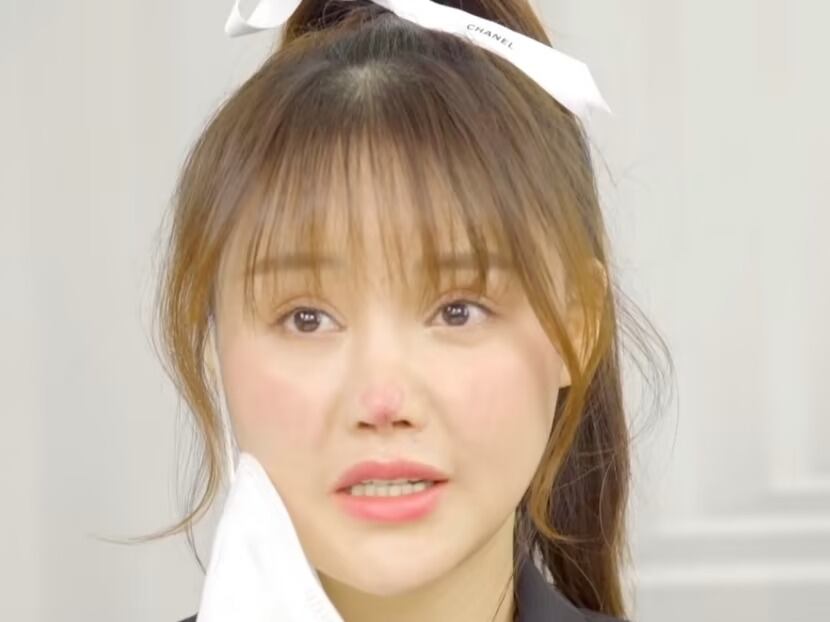 Gao Liu se ha sometido a múltiples cirugías reconstructivas, y aunque ha mejorado, todavía lidia con secuelas físicas y emocionales (Créditos: Sina Weibo)