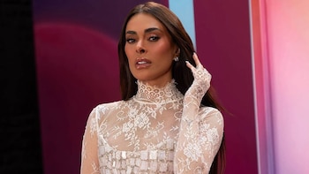 Pese a complicaciones faciales, Galilea Montijo aún se declara a favor de las cirugías estéticas