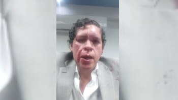 Así fue la brutal golpiza