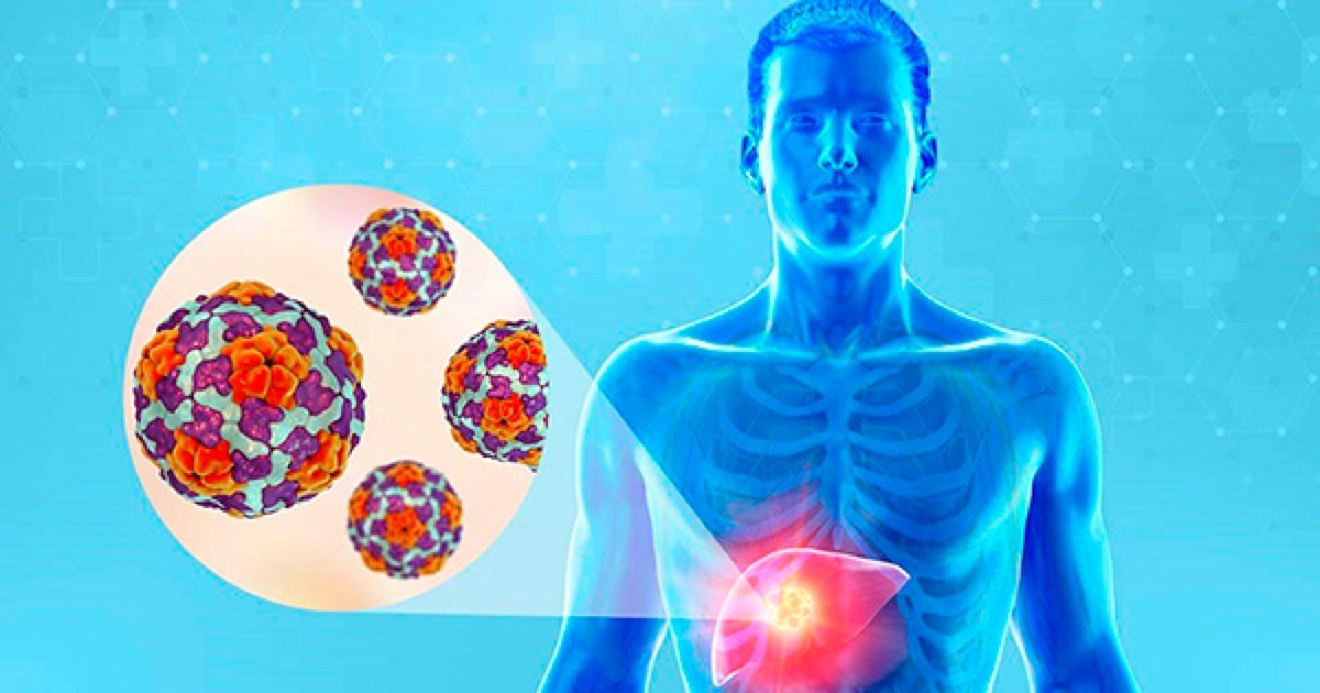 Alerta en Argentina: Aumentan los casos de hepatitis A en todo el país