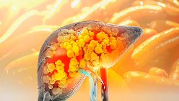 Cuáles son los efectos de