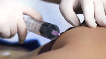 Se necesitan más estudios para