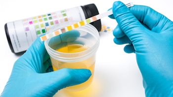 El diagnóstico temprano mediante un