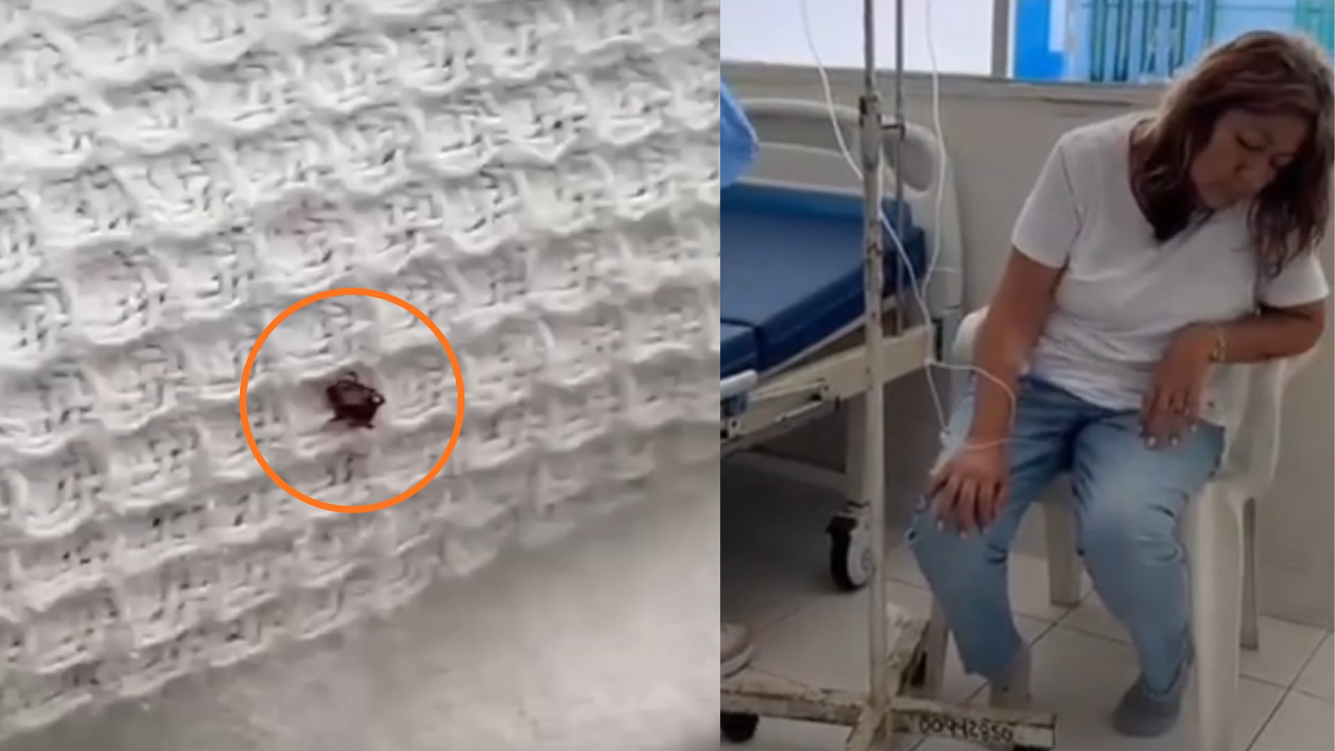 Una garrapata es visible en un tejido blanco mientras una mujer recibe atención médica con un suero intravenoso en lo que parece ser un hospital, sugiriendo una emergencia de salud relacionada (Foto: Composición Infobae Perú)