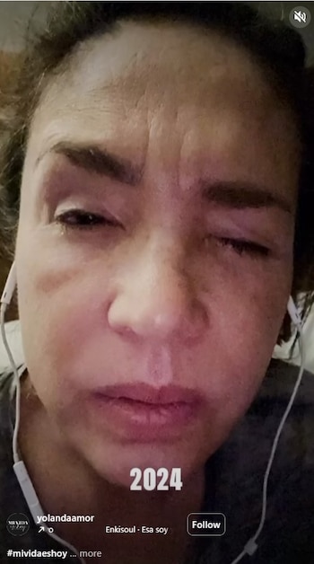 Yolanda Andrade tiene ELA. (IG)