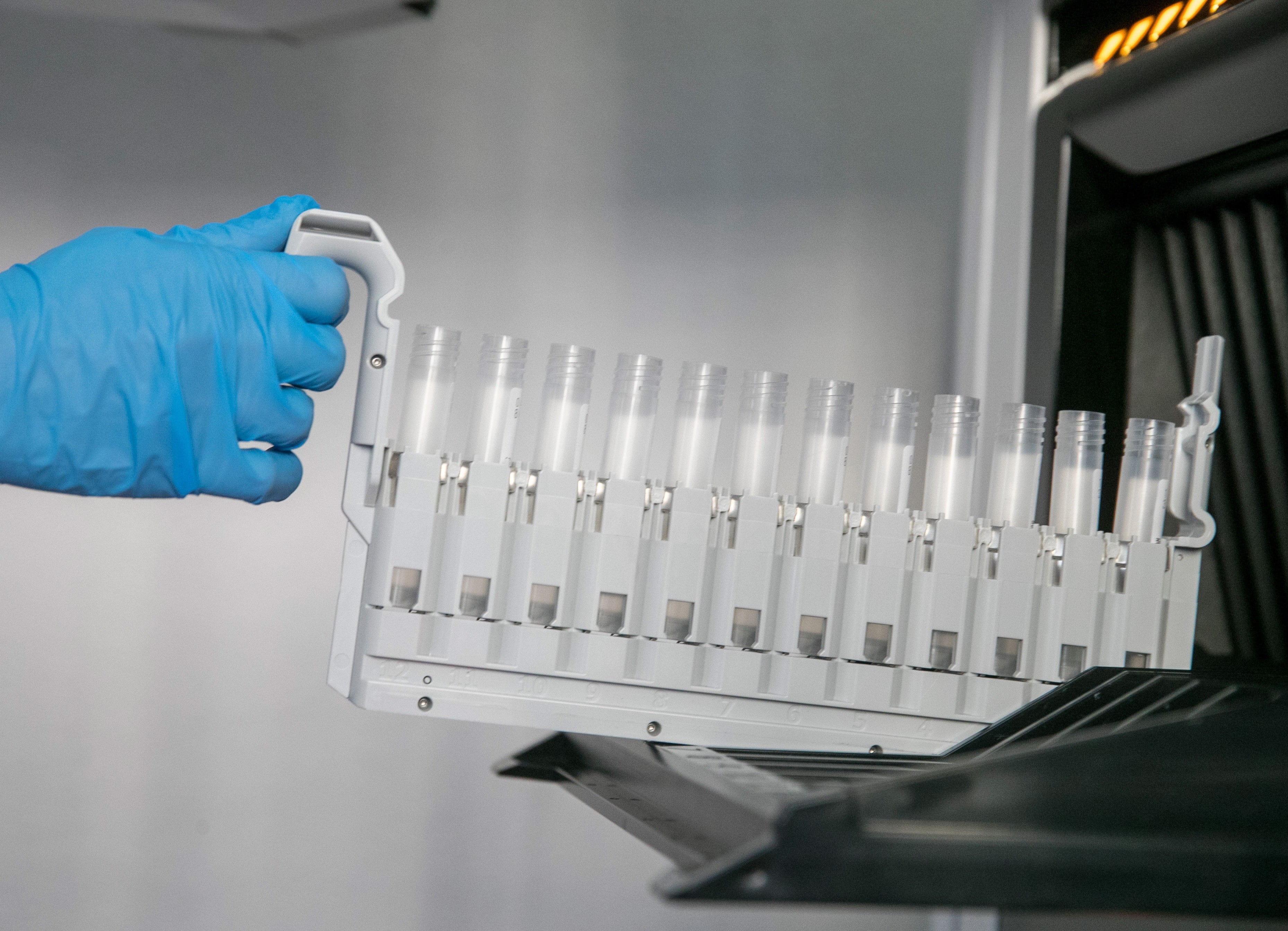 El estudio analizó la expresión de 379 genes hormonales en 14 millones de células individuales de 47 tejidos humanos distintos (Archivo EFE/Javier Cebollada)