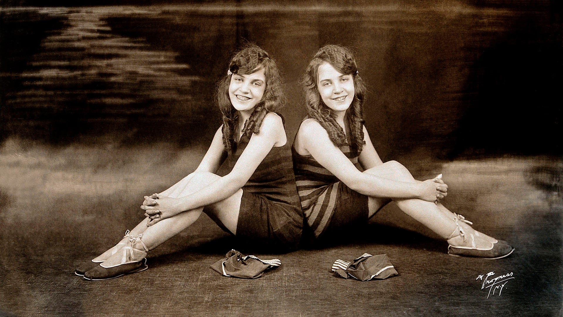 Daisy y Violet Hilton nacieron en 1908 unidas por la pelvis y los médicos descartaron una cirugía de separación por el riesgo vital que implicaba (Grosby)